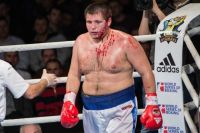 Боксер, який вигравав у Ф'юрі, вважає, що в Росії немає професійного боксу