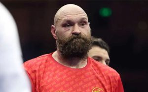 Тайсон Ф'юрі готовий побитися з Фабіо Вордлі