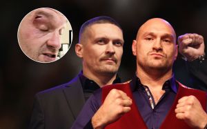 Екс-тренер Дюбуа назвав причину розсічення у Тайсона Ф'юрі перед боєм з Олександром Усиком
