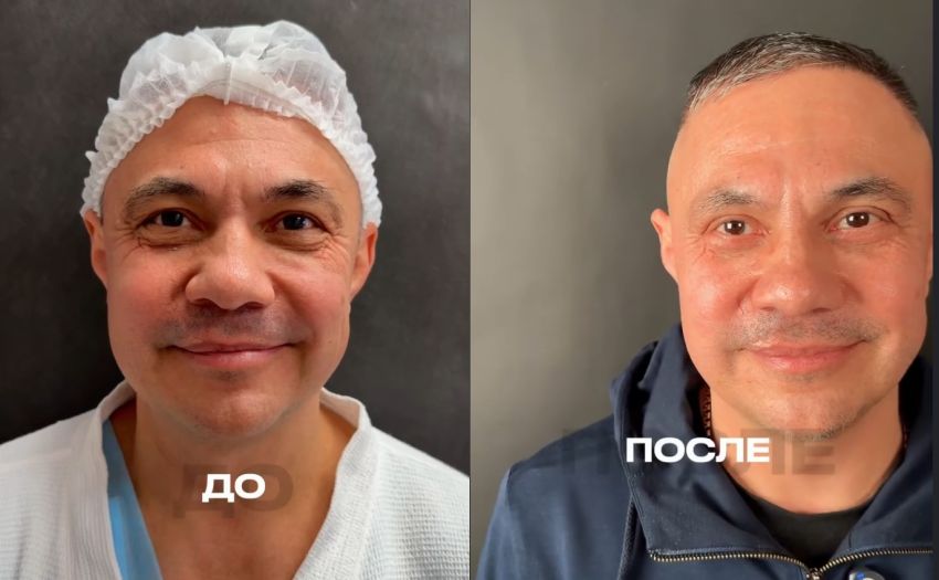 Костя Цзю зробив пластичну операцію