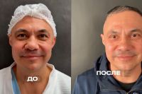 Костя Цзю зробив пластичну операцію
