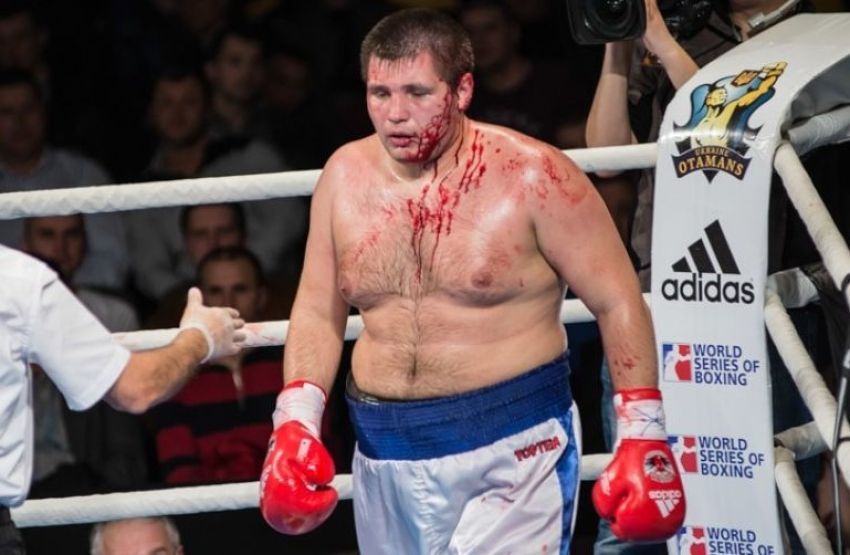 Боксер, який вигравав у Ф'юрі, вважає, що в Росії немає професійного боксу